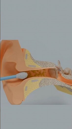 Ear Wax !😱? #shortsfeed #ytshorts #facts