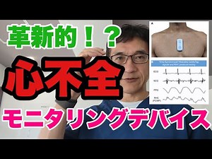 【心不全モニタリング】左心不全では必ず左房圧が上昇する。ウェアラブルデバイスによる非侵襲的な左房圧＝肺動脈楔入圧（PCWP）推定技術の革新！循環器内科医、心不全患者さんは大喜び？！