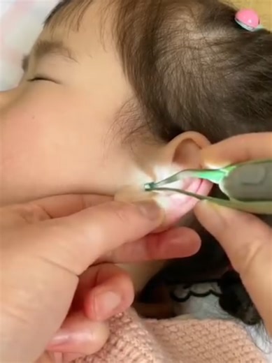 Effective Ear Cleaning Tools Reviewed