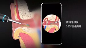 小米智能可视化采耳器Bebird M9 Pro