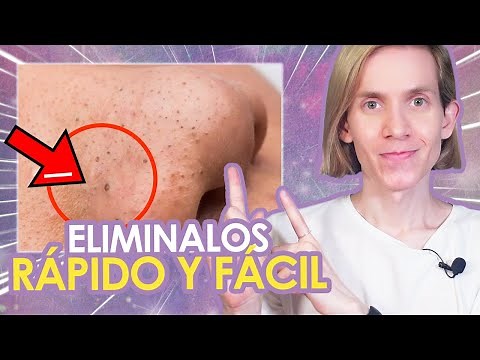 HOW TO REMOVE BLACKHEADS - Guide to anti-comedone products and routines - Simon Scarano