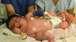 Nació en Alemania el bebé más grande del mundo