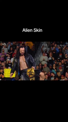 Alien Skin #alienskinug