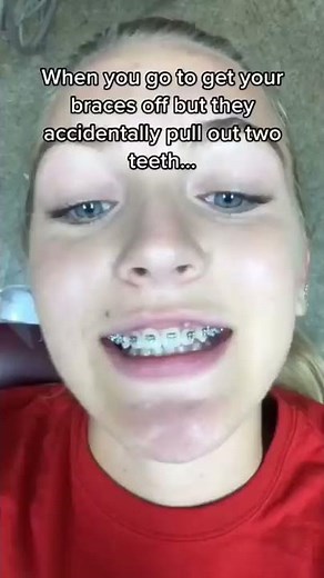 This Orthodontist Accidentally Pulled My Teeth Out!