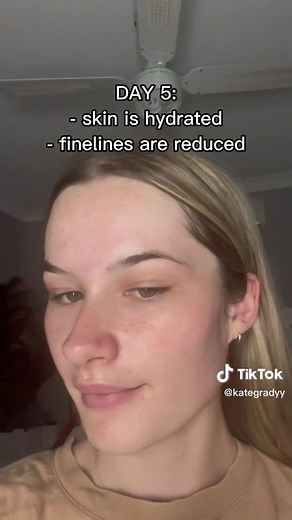 Transform Your Skin with Depology's Matrixyl 3000 Serum | Before & After Results!