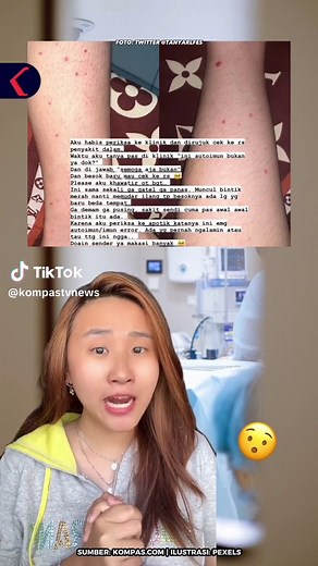 Bintik Merah di Tangan: Tanda Autoimun atau Vaskulitis?