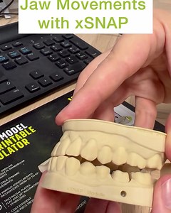 Official xSNAP Modul for 3Shape DS2022/23 Lab Version demonstrating the digital Trios Workflow including the 3D articulated xSNAP Model..🤩 More information: www.x-snap.net Get your 3Shape/xSNAP Modul with your Dongle ID under: https://www.x-dentaldepot.com/en/xsnap/1797-xsnap-add-on-modul-for-model-builder-3shape.html Special Thanks to Manuel Fricke, Alessandro Blaauw & 3Shape, Constance Ludwig #3shape #3shapetrios #3shapedesign #3shapescanner #3shapeorthodontics #3shapetrios3 #3shapebrasil #3s