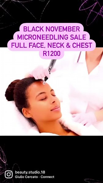 BLACK NOVEMBER MICRONEEDLING SALE FULL FACE, NECK & CHEST R1200 Book your appointment on the Fresha App https://www.fresha.com/book-now/beautystudio-by-collette-co-s7dwrhxt/all-offer?id=500466&pId=467450 🙏 #RESORCINOL #AcidPeels #Anti #Ageing #Chemical #Dermaplaning #Exfoliation #HealthySkin #Salicylic #Glycolic #Peels #darkspot #Dark #5starreviews🌟🌟🌟🌟🌟 #Wrinkles #blackheads #beautystudiobycollette #pimples #retinolpeel #getglowing #micropeel #edenvalebeauty #fyp #pigmentation #acne #skinr
