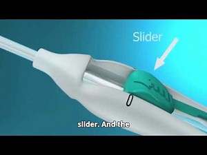 CopperT placement and removal||Mirena hormonal intrauterine device (IUD)||#viral #contraceptives