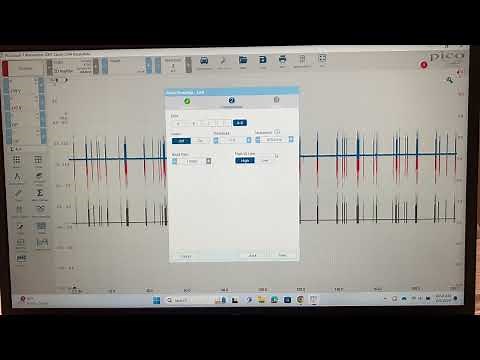 Using the Picoscope and Serial Decoding to Analyze CAN Bus Data