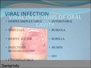 Viral Infection Of Oral Cavity ( Full Version )