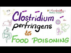 Clostridium perfringens Food 🥘 Poisoning 🤮 | Microbiology 🧫 & Infectious Diseases
