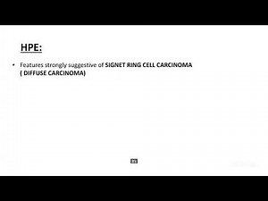 PG CLINICS GASTRIC OUTLET OBSTRUCTION