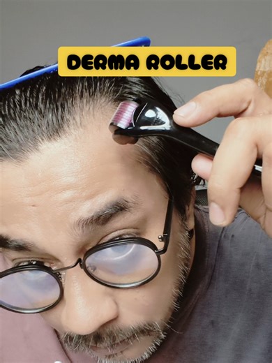 Unlock Fuller Facial Hair with Our Premium Derma Roller