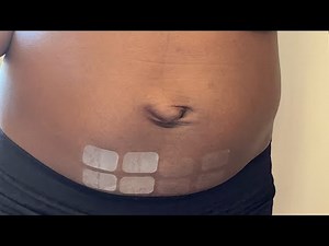 Estradot- Estrogen HRT Patches 🌸 Change Day Steps. 200dose