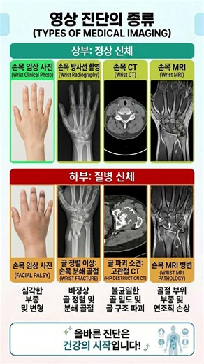 ​"골절은 X-ray, 인대는 MRI? 내 몸에 맞는 의료 영상 완전 정복"​ #영상진단 #CT #MRI #엑스레이 #MRI #골절 #디스크 #건강관리 #메디컬에듀 #내몸에맞는검사