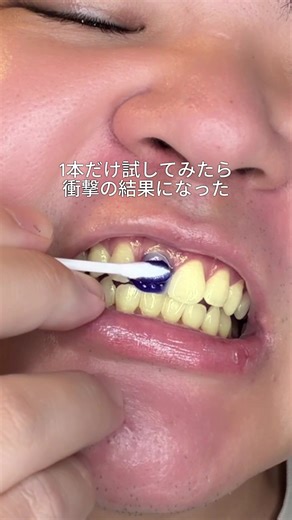 海外で話題の紫歯磨き粉のおすすめ
