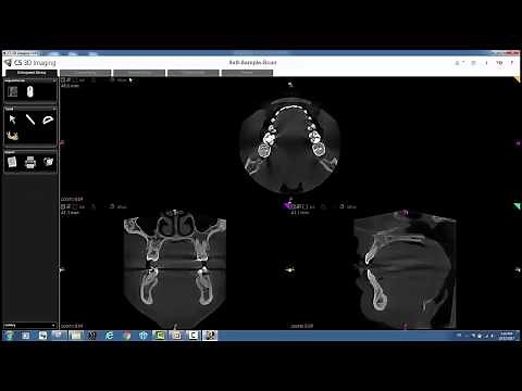 Carestream 3D Imaging - Receiving CBCT Scans