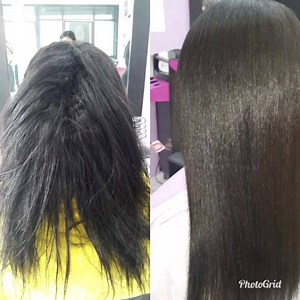 5.5K views · 49 reactions | #Botox_Cirugia_capilar...