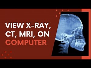 How to Open a DICOM File: Free DCM File Viewer Guide