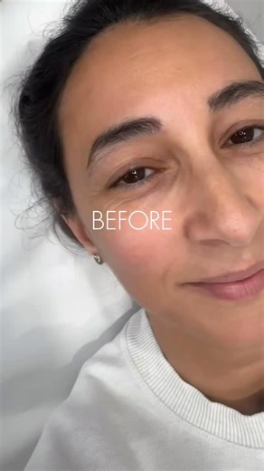 ✨✨ حواجبك… سرّ جمالك! ✨✨ 💎 لمسة احترافي 💎 شكل طبيعي 100% 💎 تصميم يناسب ملامح وجهك ————- ✨✨ Perfect Brows Start Here! ✨✨ 💎 Professional technique 💎 Natural results 💎 Customized brow design #Microblading #BrowsOnFleek #BrowArt BeautySalon BrowDesign SemiPermanentMakeup NaturalBrows BrowTransformation | Miray Hakimeh