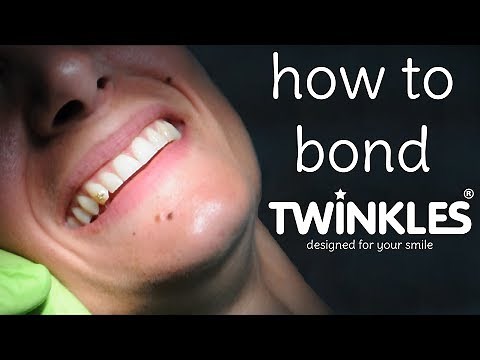 Twinkles Dental Jewelry - Bonding Instructions