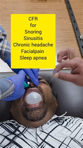 Sinusitis,snoring,sleepapnea,chronicheadache,migraine treated with #cfr #cranialfacialrelease #sinus