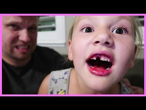 PULLING OUT HER OWN TOOTH!