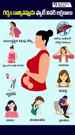 Early warning Signs of Fatty liver in Pregnancy #pregnancyhealth #fattyliver #ytshorts #healthtips