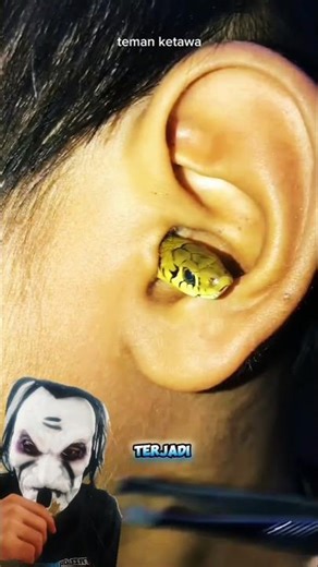 "Saat Ular Menghuni Telinga Manusia"#shortsviral #trending #shortsfeed #remix