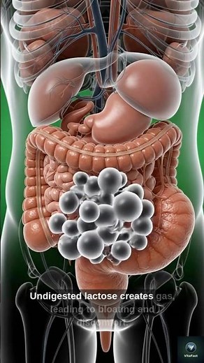 Why Drinking Milk Causes Stomach Pain? 🥛🤢 (Lactose Intolerance Explained) #viral #fyp #science