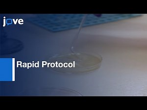Preparation Of Electrocompetent E. coli & Vibrio cholerae l Protocol Preview