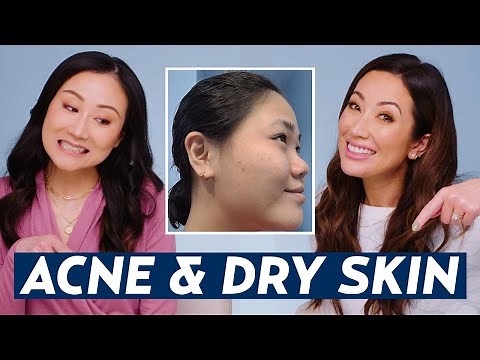 Best Skincare Routine for Acne & Dry Skin? Dermatologist Advice for Lisa! | DERMATOLOGIST REACTS
