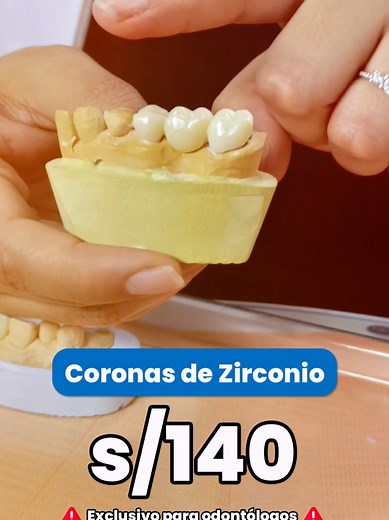 Laboratorio de Zirconio CAD/CAM para Odontólogos | Coronas de Zirconio desde s/140