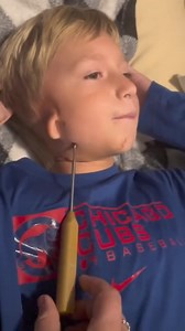 Well that’s one way to stretch out your jaw! Technology and science is crazy. Thank your oral surgeons out there! #jawdistractor #jawsurgery #reaction | TheBentistofficial