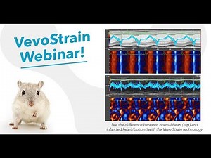 Oct 2017 VevoStrain - Understanding Subtle Cardiac Changes