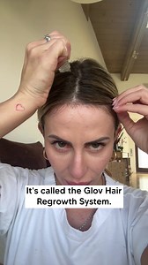 Hair Loss or Slow Growth? According to world renowned hair loss specialist Dr. Lauren Atwood there's a hidden poison that slows down and stops hair growth. Find out exactly what's causing so many Americans to lose hair—and what's helping thousands powerfully improve their hair growth and scalp health. Try Glov Hair Regrowth System now 👉https://glovbeauty.com/pages/ghrs | Trichologist Journal