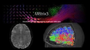 MRtrix3-弥散像分析和神经纤维束追踪-07：大脑连接组Connectome