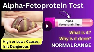 Alpha-Feto Protein Test: Diagnosing Liver, Testicular, and Ovarian Cancers | Pathofast Lab Pune | HIV, Semen, Home Blood Test posted on the topic | LinkedIn