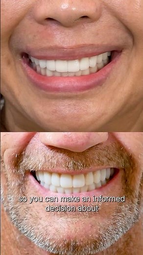 Missing Teeth? Here’s What You Need to Know | My Implant Dentist