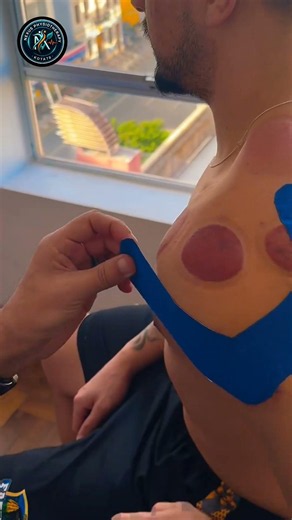 Shoulder Pain | Bicep Tendonitis | Rotator cuff Tendonitis | Shoulder Taping | Kinesiology taping