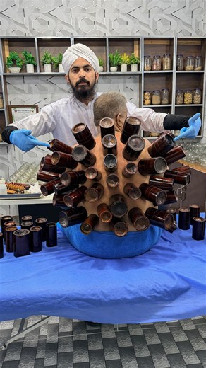 Back & Shoulder Pain Relief with Chinese Bamboo Cupping Therapy Real Therapy Session | Dr Usman Faiz
