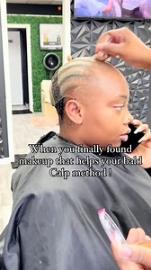 The bald cap method is a special way of applying a wig cap that makes the wig cap look exactly like your actual scalp. It’s primarily used with lace wigs, including lace fronts, lace closures, and full lace wigs. When done correctly, the bald cap method can give you a more natural-looking wig installation, help your hair lay flat, and create a longer-lasting wig melt. | Her Luxe