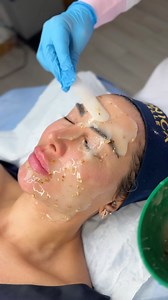 0 makeup, Just a glowing, light reflecting skin like a mirror 🪞I loved this Lifting facial, because I saw immediate results, and the process was so relaxing and calming 😴 @clinicajoelleofficial #clinic #dubai #abudhabi #qatar #cairo #jordan #algerie #algeria #joellemardinian | Joelle Mardinian