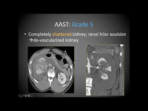 Imaging findings in Urinary tract trauma