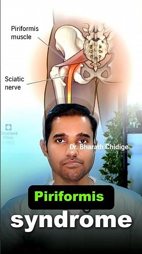 Relieve Piriformis Tightness with These Simple Stretches