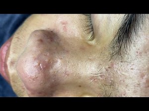 Sac dep spa best videos today 2025