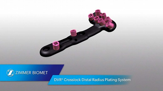 DVR® Crosslock Distal Radius Plating System