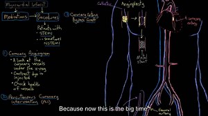 【搬运KhanAcademy】循环系统疾病——Heart attack interventions and treatment