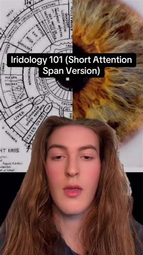 #naturalhealing #holistichealth #iridology | holistic health